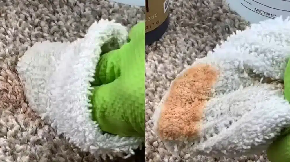 Apply Hydrogen Peroxide
